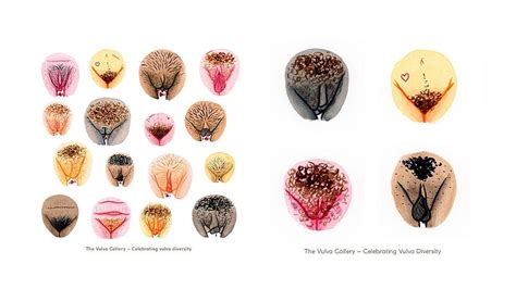 vulva gallery